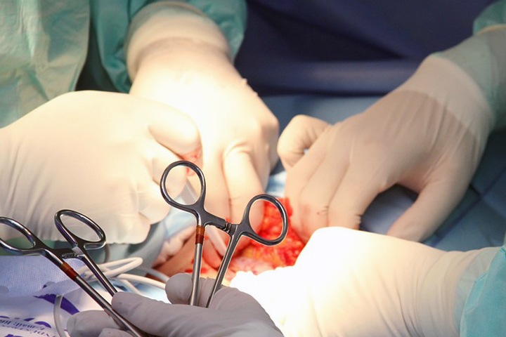Новосибирский хирург провел уникальную операцию по удалению органов таза