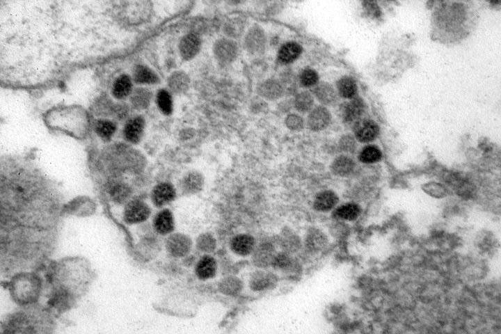 Омикрон-штамм коронавируса обнаружен в Туве